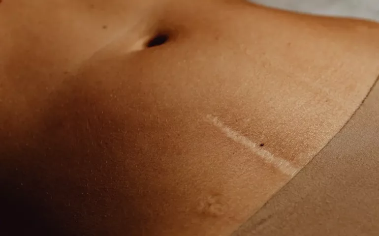 Douleurs au ventre au 1er mois de grossesse : est-ce normal ?