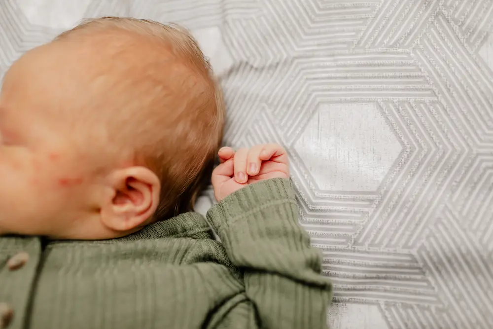 L'érythème toxique du nouveau-né, un mal bénin 2 L'érythème toxique du nouveau-né - May App Santé