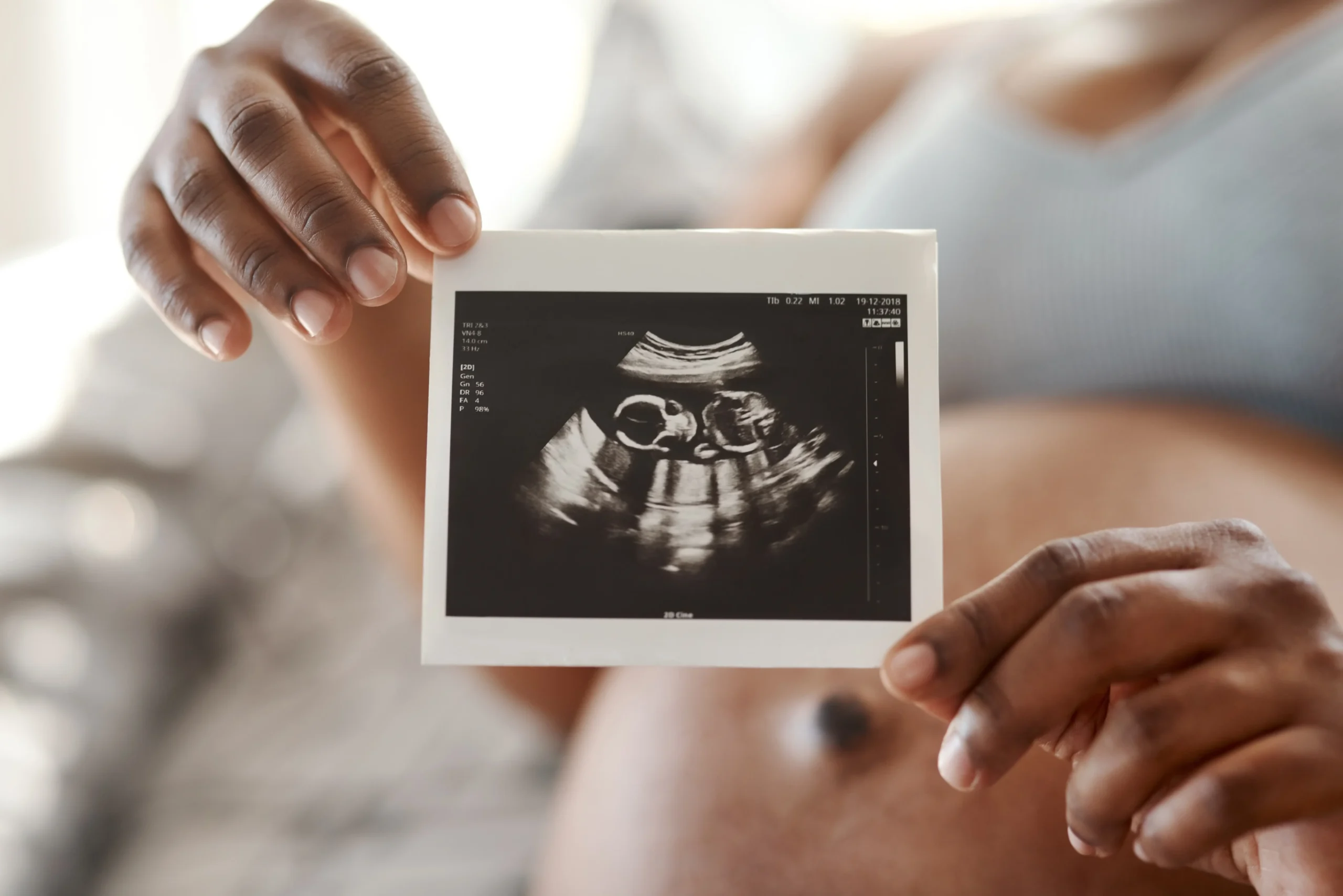 L’échographie pelvienne pendant la grossesse : à quoi sert-elle et comment se déroule-t-elle ? - May app santé