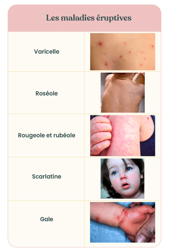 Boutons, plaques rouges et éruption cutanée bébé May app