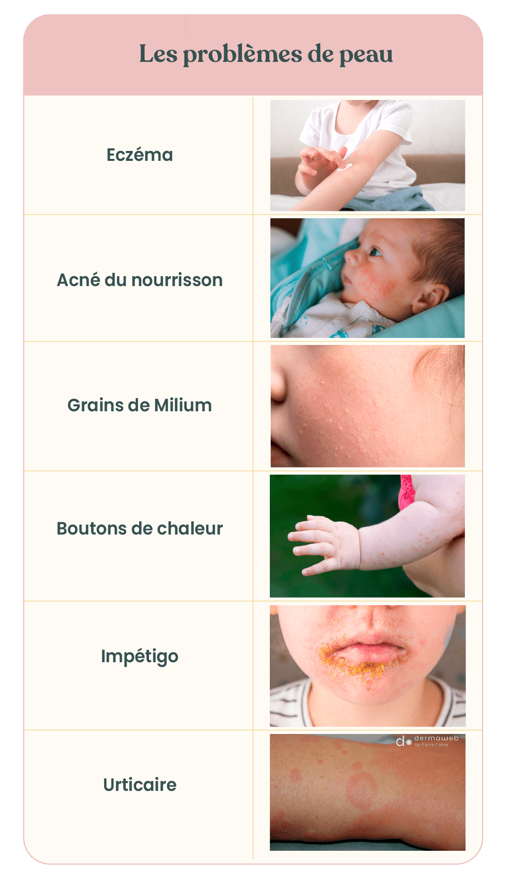 Boutons, plaques rouges et éruption cutanée bébé