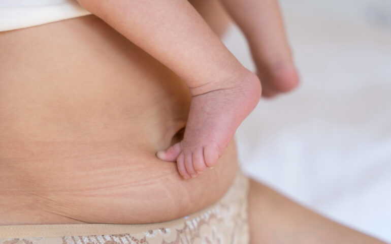 J'ai perdu du poids après la grossesse : est-ce normal ?