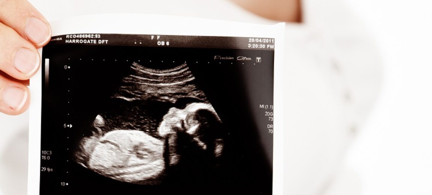 Echographie de grossesse à 22 semaines d'aménorrhée 
