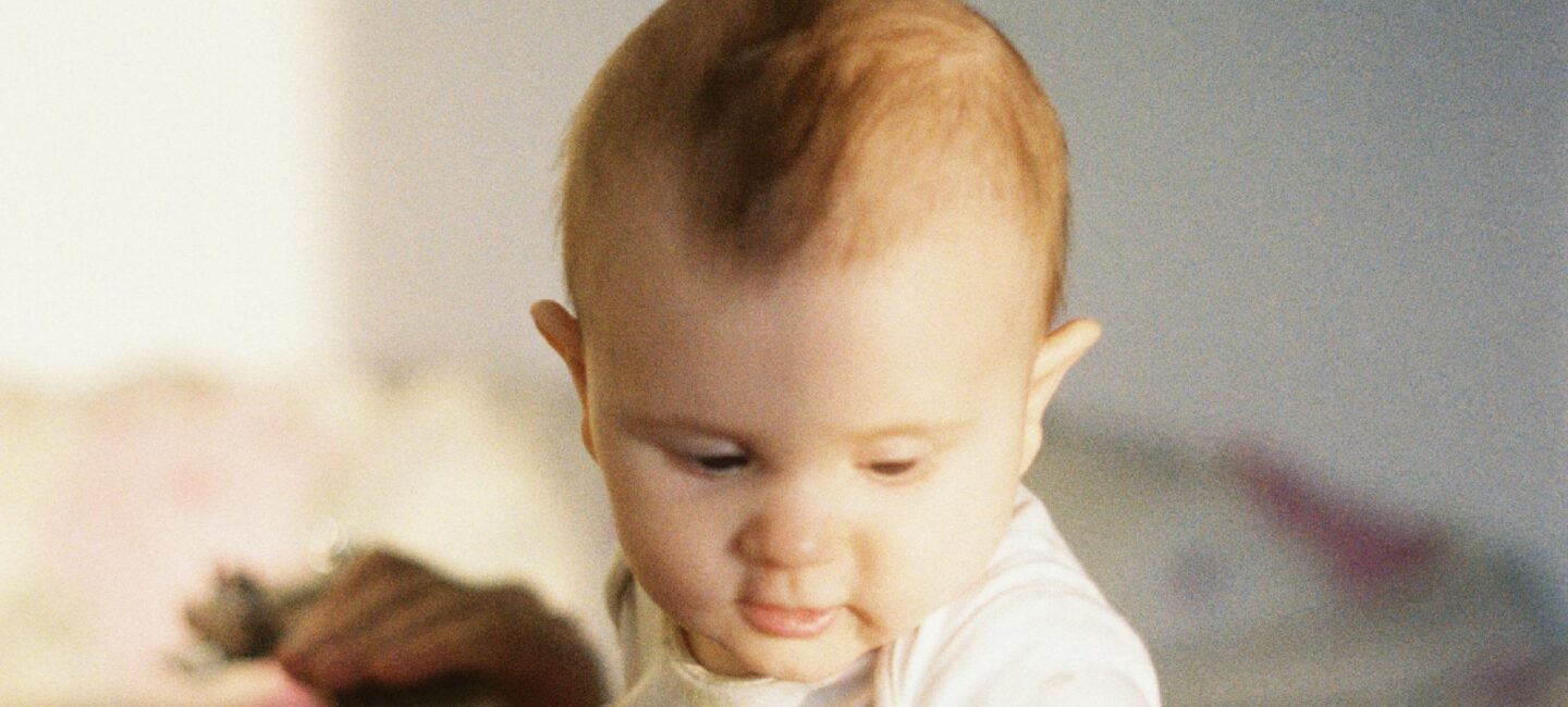 perte cheveux bébé