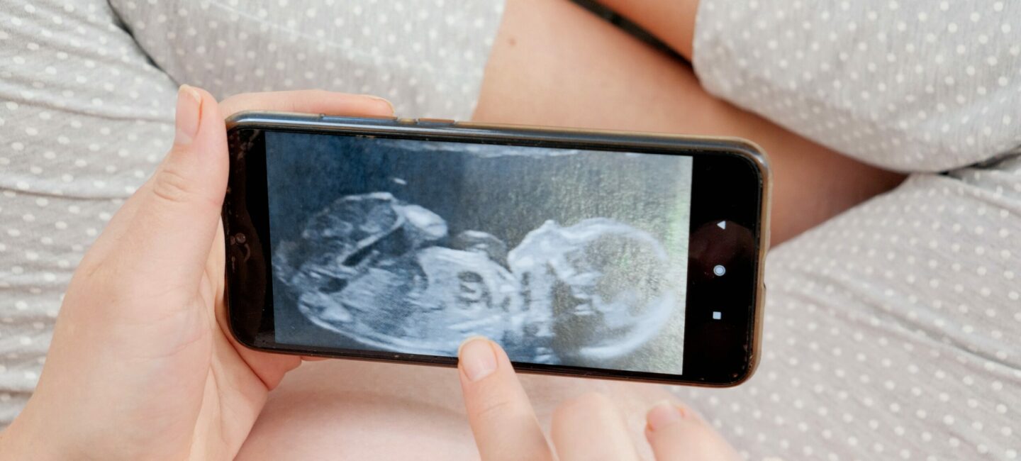 fœtus mesure de la clarté nucale