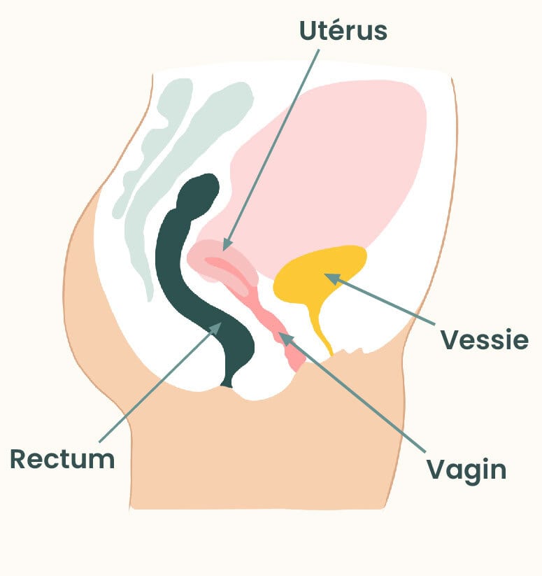 uterus retroverse