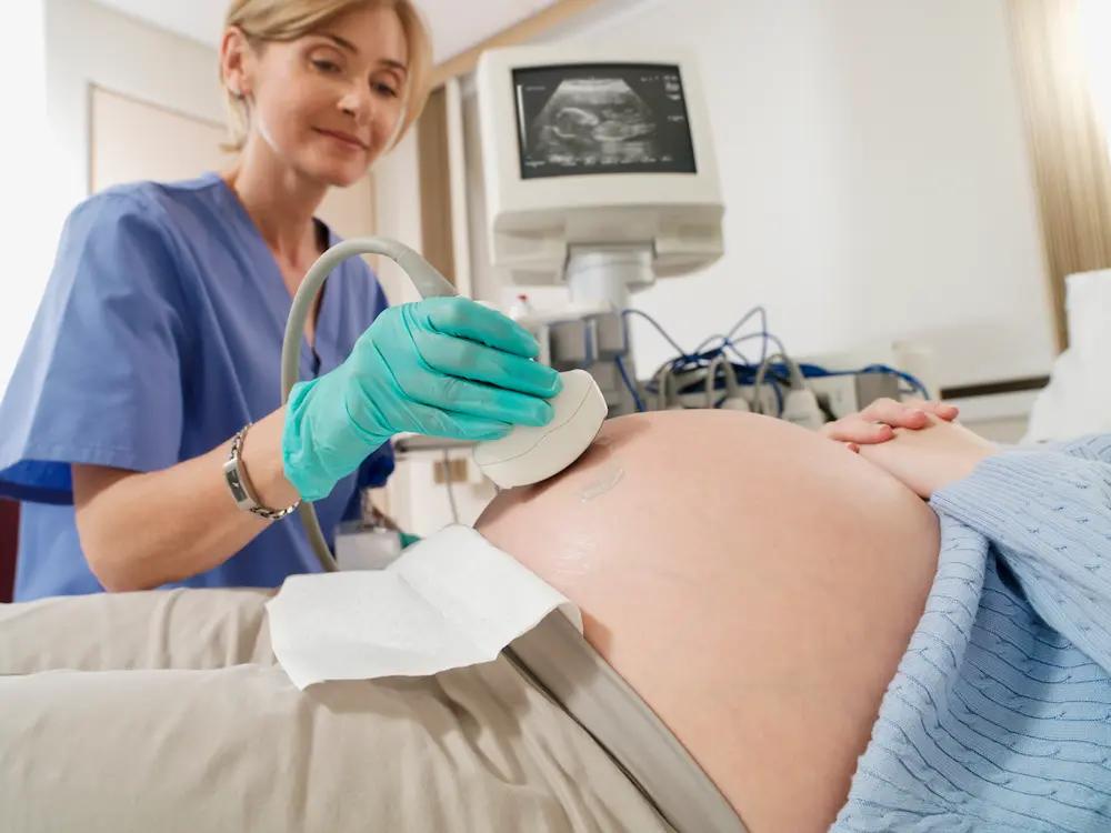 La deuxième échographie de grossesse : tout ce que vous devez savoir 1 La deuxième échographie de grossesse : tout ce que vous devez savoir - May App Santé