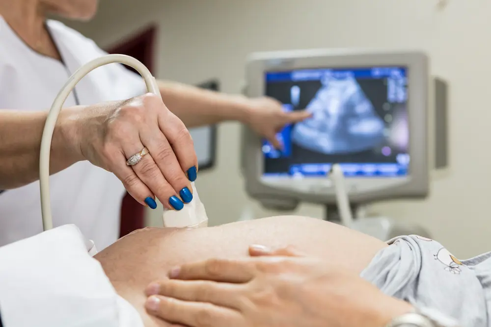 La deuxième échographie de grossesse : tout ce que vous devez savoir 4 La deuxième échographie de grossesse : tout ce que vous devez savoir - May App Santé