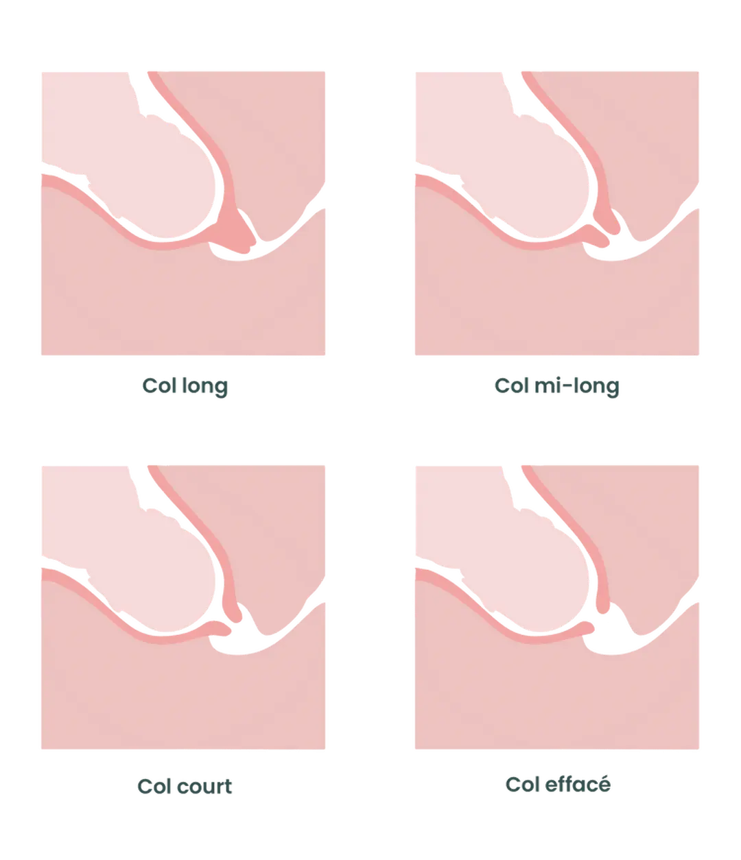 accouchement phase de latence