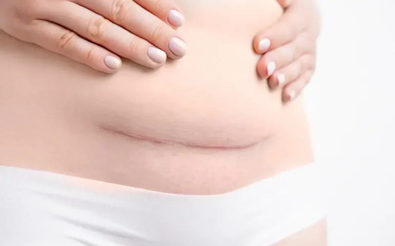 Guide pratique pour la rééducation du périnée en post-partum May app santé