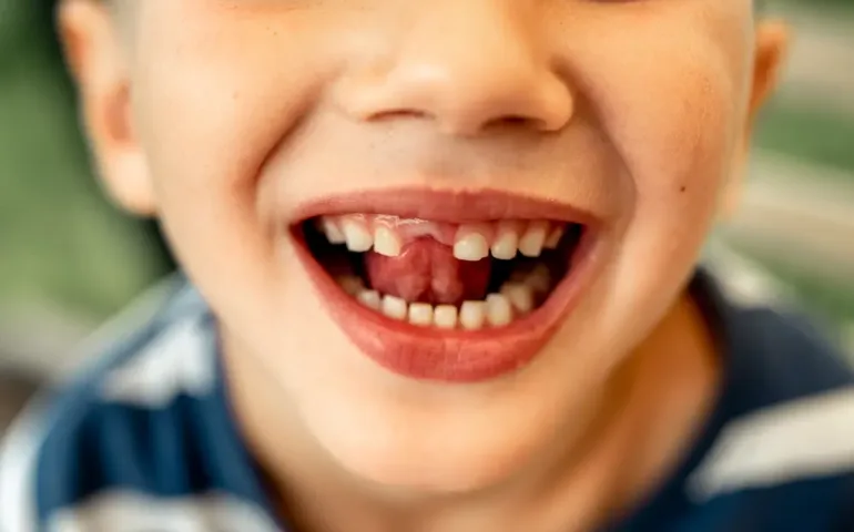 Tout savoir sur les dents de lait may app santé