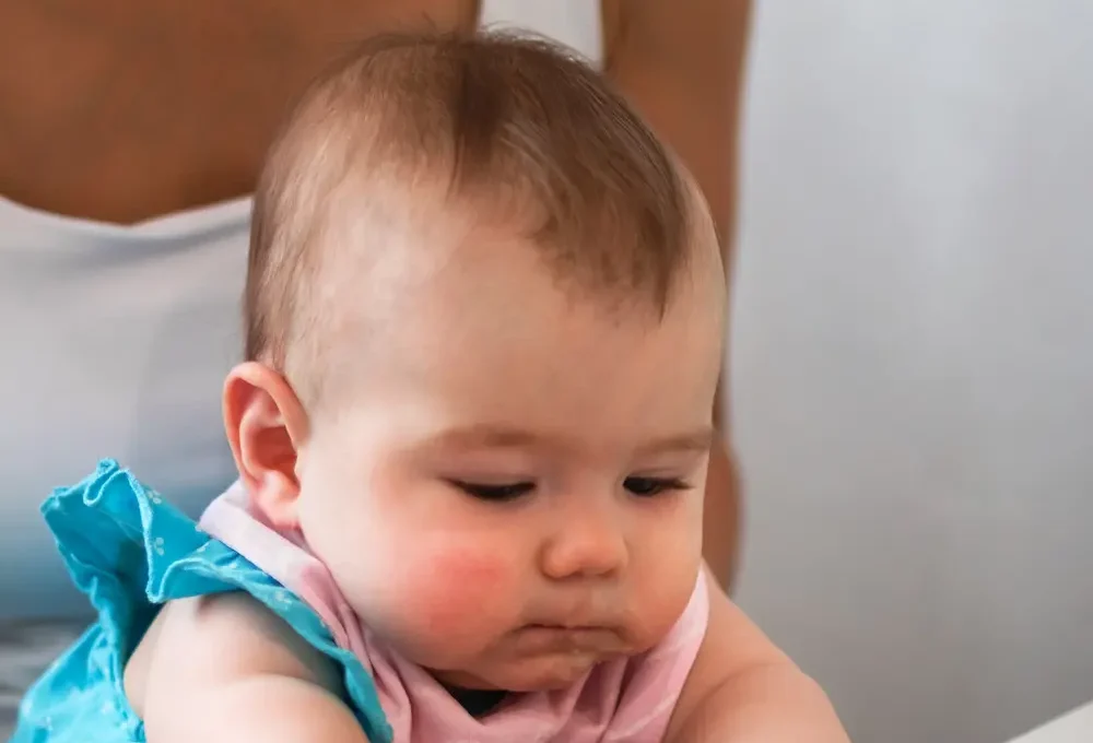 Anaphylaxie chez l'enfant : comprendre et agir may app santé
