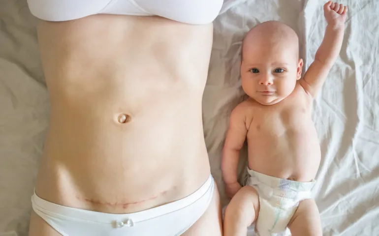 Descente d'organe après l’accouchement : que faire ? may app santé