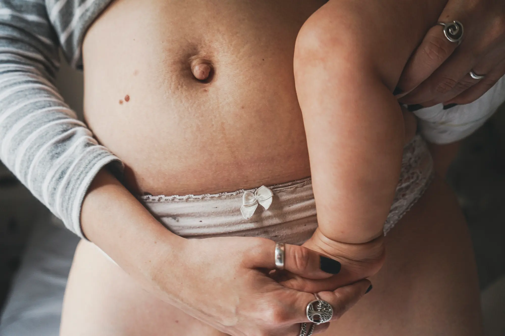 Diastasis grossesse : le comprendre et le prévenir may app santé