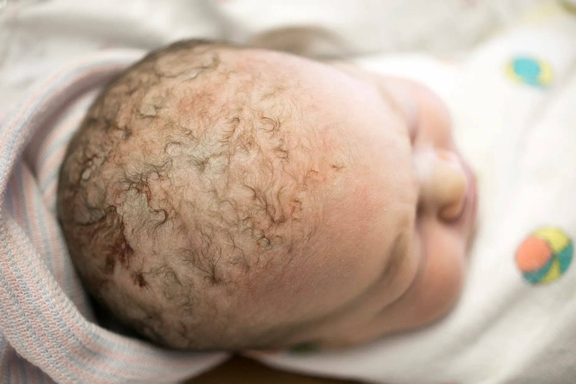 Sécheresse du cuir chevelu chez le bébé : causes et solutions may app santé