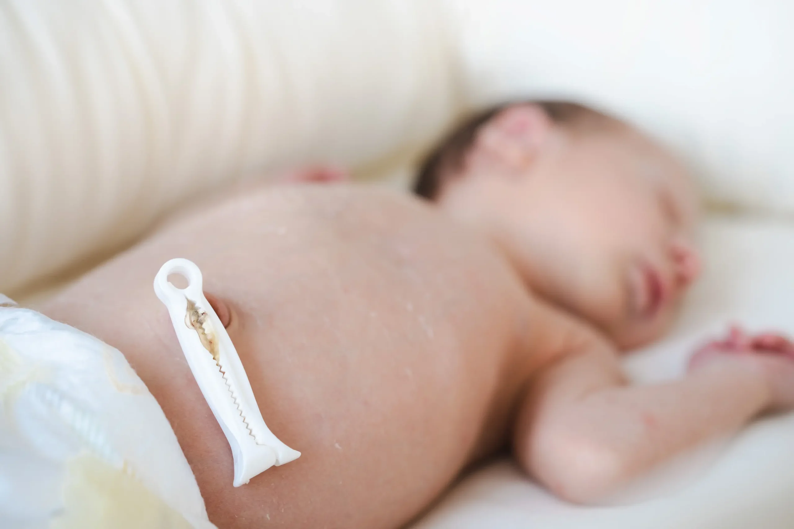 Cordon ombilical qui sent mauvais : causes et solutions may app santé