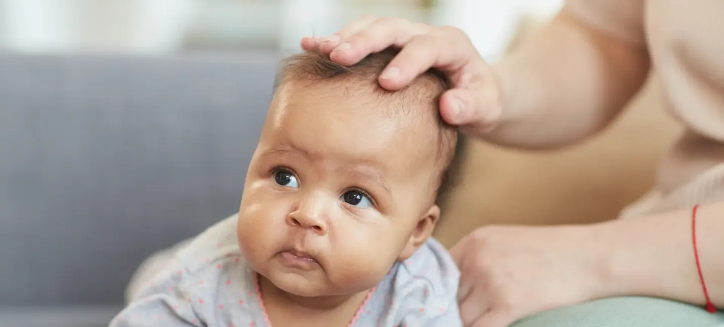 Sécheresse du cuir chevelu chez le bébé : causes et solutions may app santé