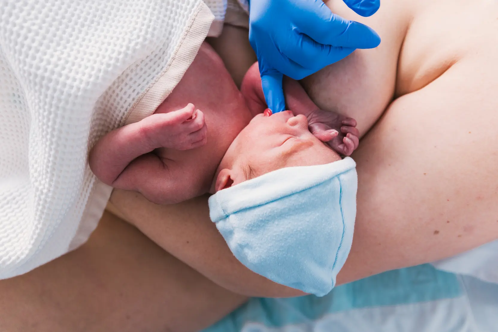 Convalescence après une césarienne : guide pratique may app santé