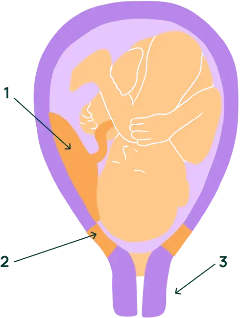 Placenta antérieur durant la grossesse : ventre plus gros ? 1 Placenta antérieur durant la grossesse : ventre plus gros ? - May App Santé