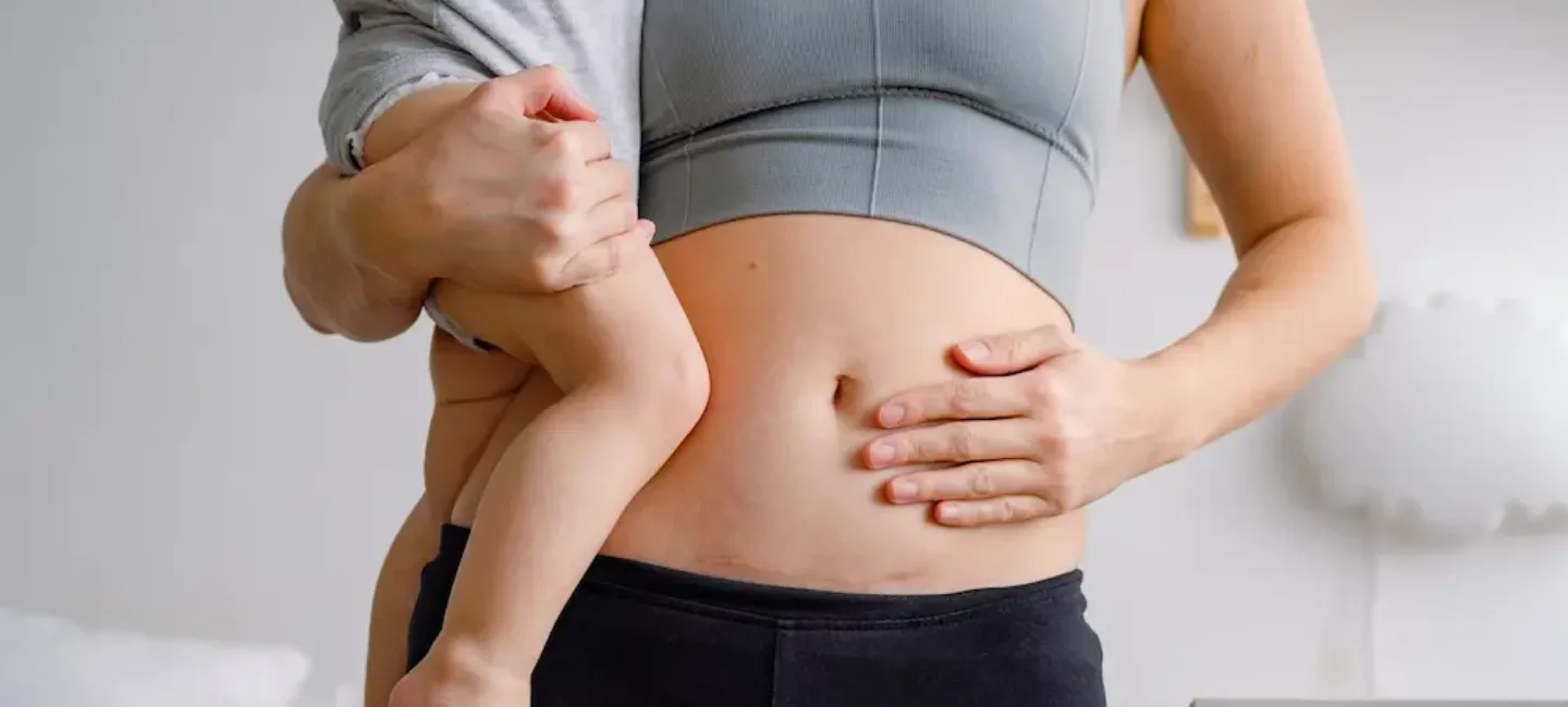 Cicatrice épisiotomie boule : causes, symptômes et solutions - May App Santé